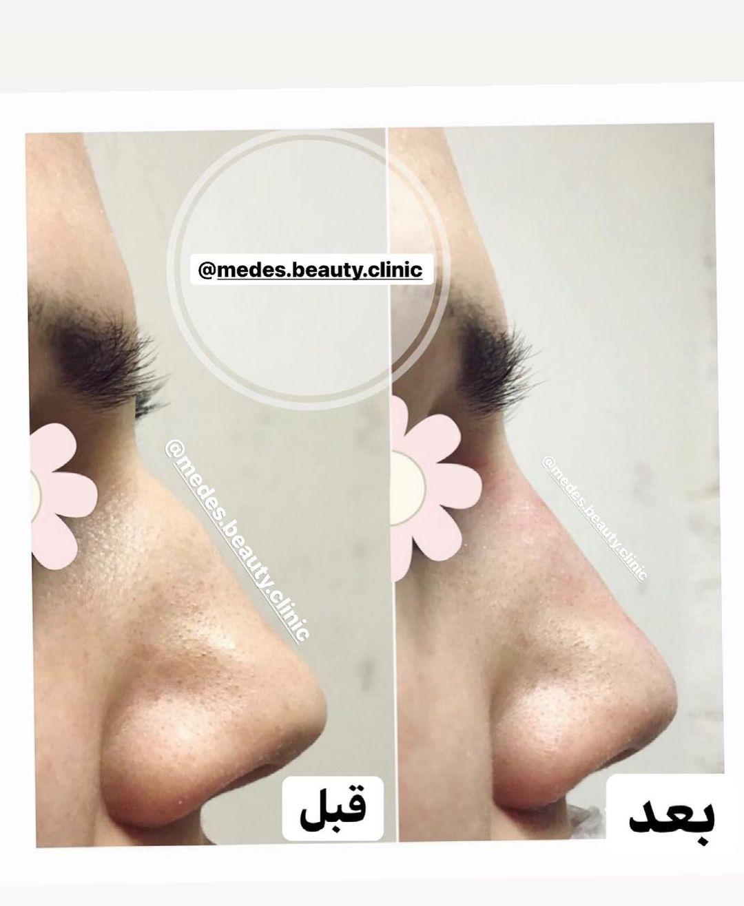 گالری اصلاح فرم بینی